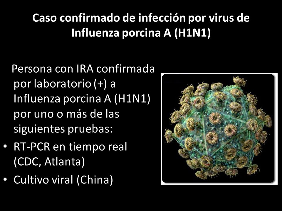 Caso confirmado de infección por virus de Influenza porcina A (H1N1)