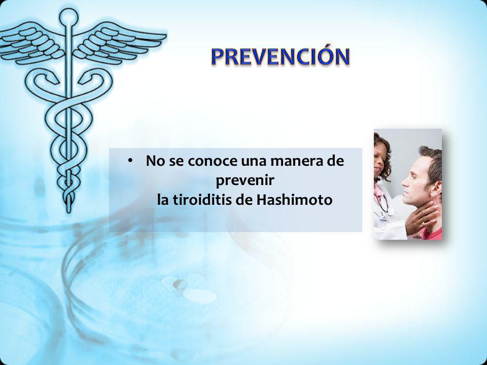 No se conoce una manera de prevenir la tiroiditis de Hashimoto