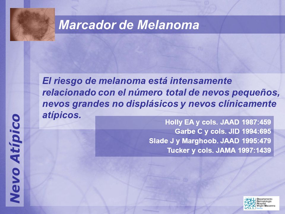Marcador de Melanoma Nevo Atípico