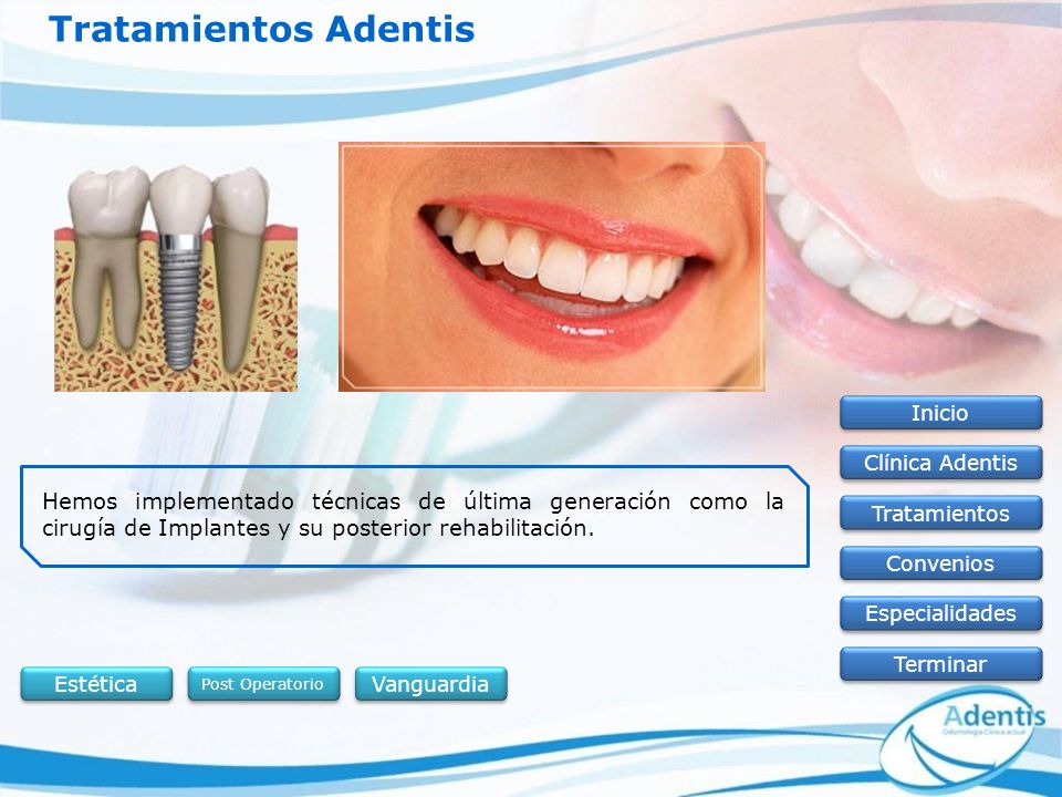Tratamientos Adentis Inicio. Clínica Adentis.