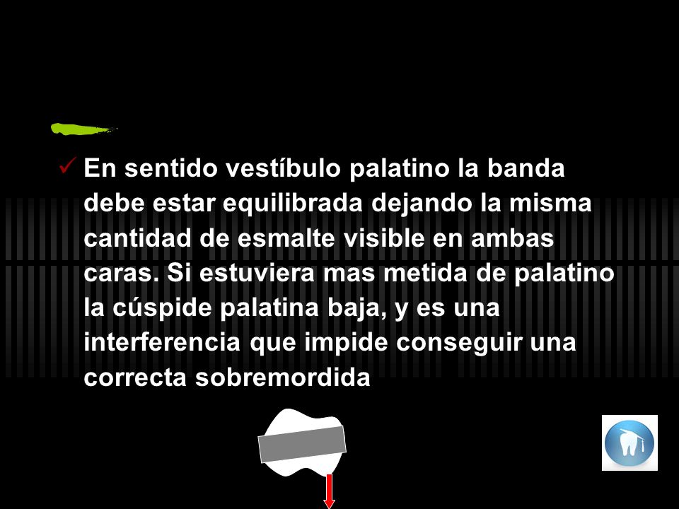 En sentido vestíbulo palatino la banda debe estar equilibrada dejando la misma cantidad de esmalte visible en ambas caras. Si estuviera mas metida de palatino la cúspide palatina baja, y es una interferencia que impide conseguir una correcta sobremordida