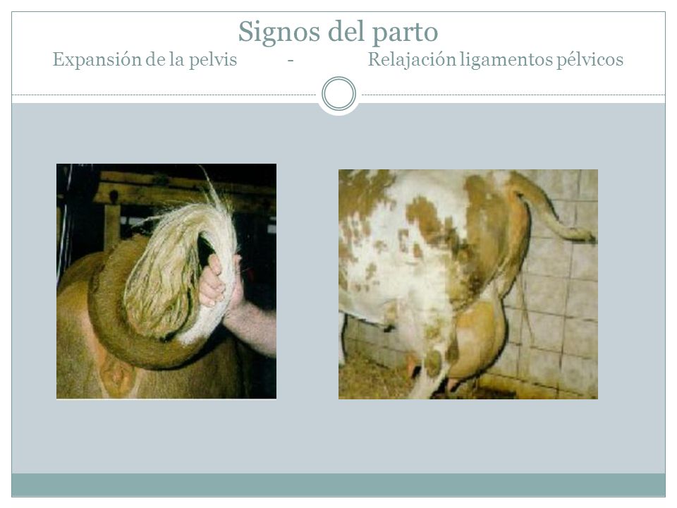 Signos del parto Expansión de la pelvis - Relajación ligamentos pélvicos