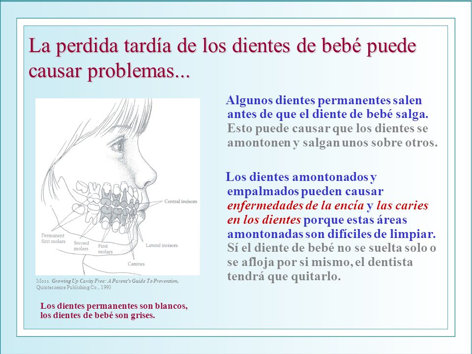 La perdida tardía de los dientes de bebé puede causar problemas...