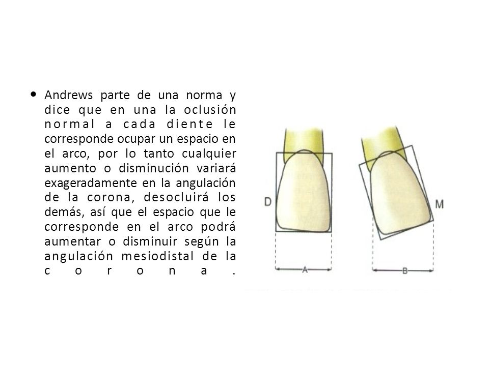 Andrews parte de una norma y dice que en una la oclusión normal a cada diente le corresponde ocupar un espacio en el arco, por lo tanto cualquier aumento o disminución variará exageradamente en la angulación de la corona, desocluirá los demás, así que el espacio que le corresponde en el arco podrá aumentar o disminuir según la angulación mesiodistal de la corona.