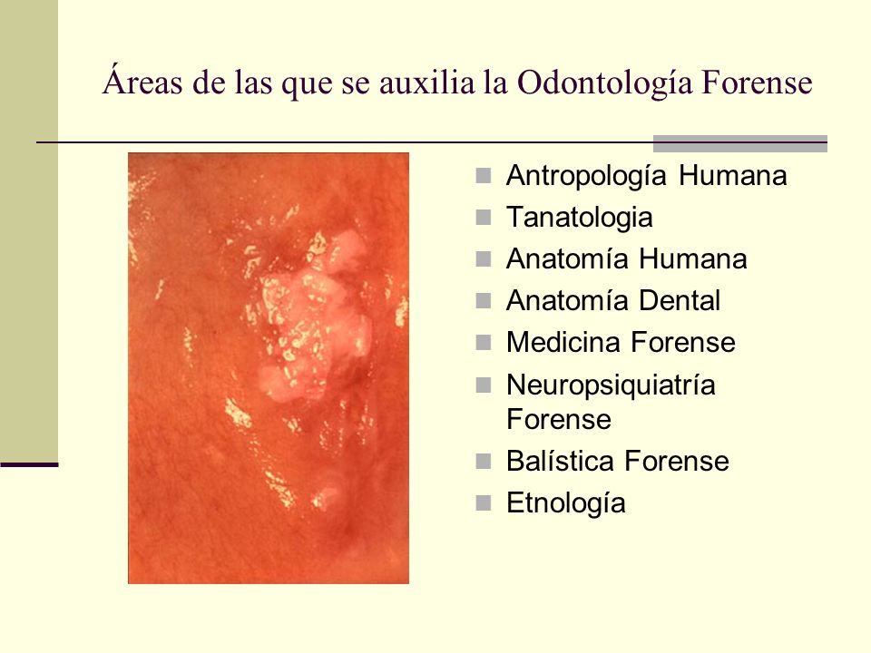 Áreas de las que se auxilia la Odontología Forense