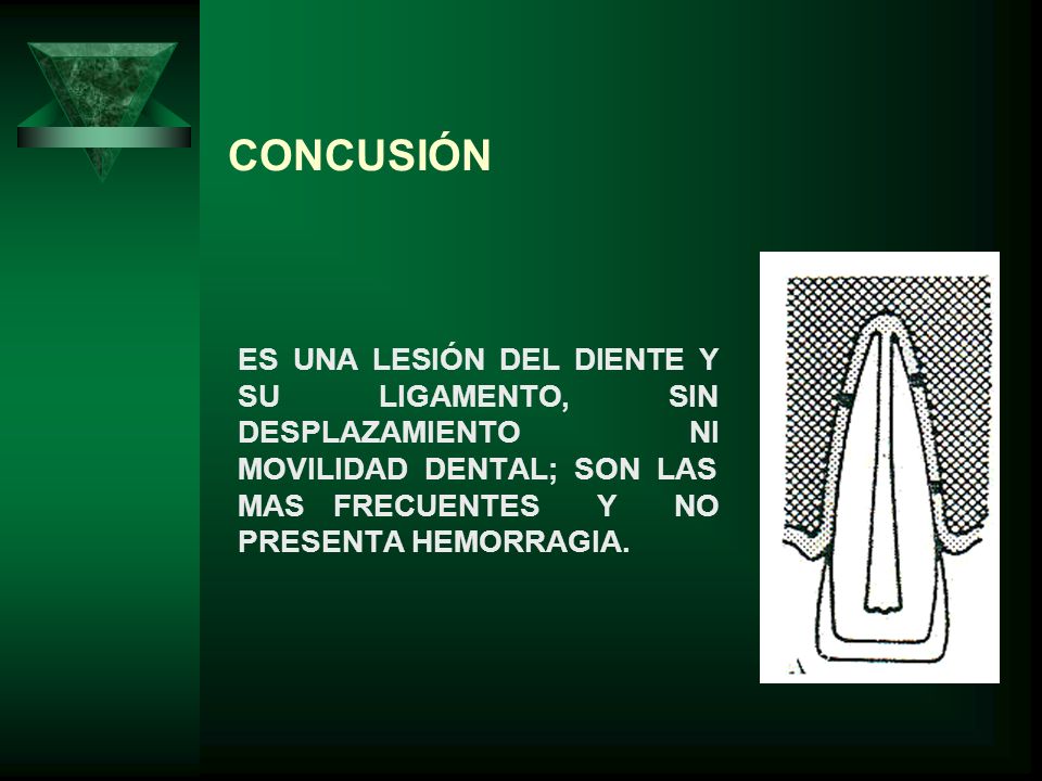 CONCUSIÓN ES UNA LESIÓN DEL DIENTE Y SU LIGAMENTO, SIN DESPLAZAMIENTO NI MOVILIDAD DENTAL; SON LAS MAS FRECUENTES Y NO PRESENTA HEMORRAGIA.