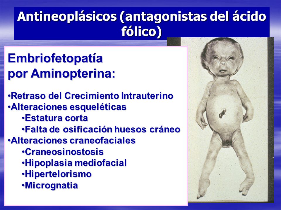 Antineoplásicos (antagonistas del ácido fólico)