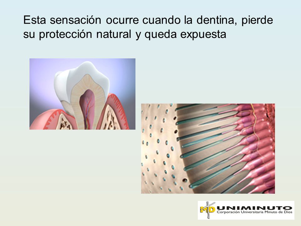 Esta sensación ocurre cuando la dentina, pierde su protección natural y queda expuesta