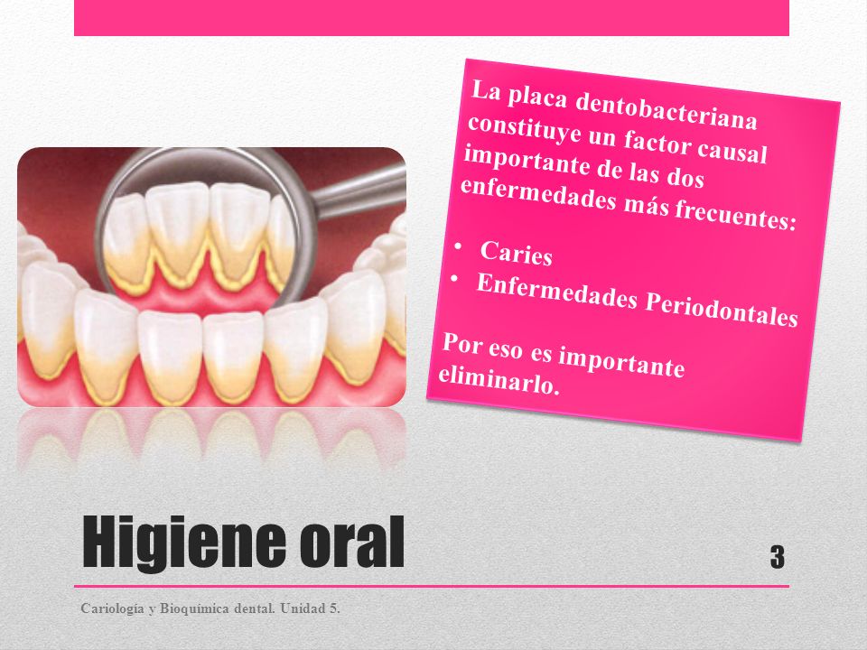 La placa dentobacteriana constituye un factor causal importante de las dos enfermedades más frecuentes: