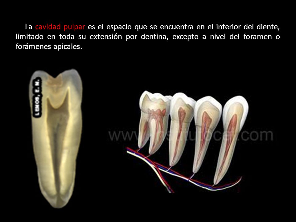 La cavidad pulpar es el espacio que se encuentra en el interior del diente, limitado en toda su extensión por dentina, excepto a nivel del foramen o forámenes apicales.