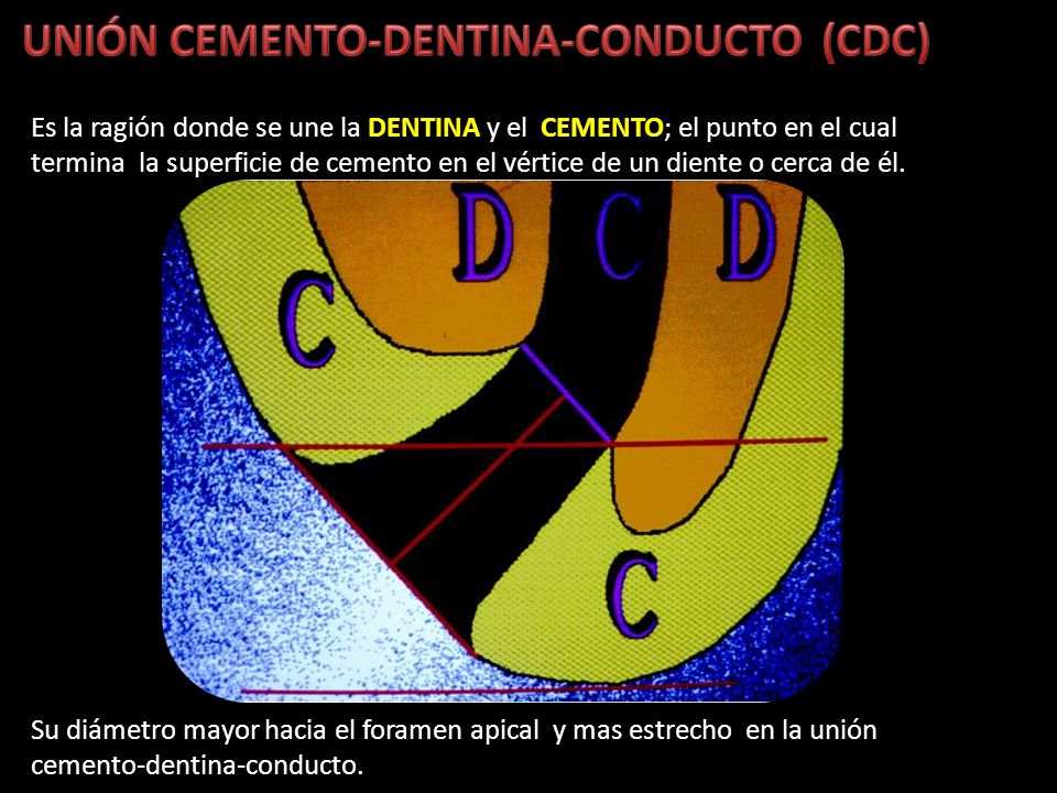 UNIÓN CEMENTO-DENTINA-CONDUCTO (CDC)