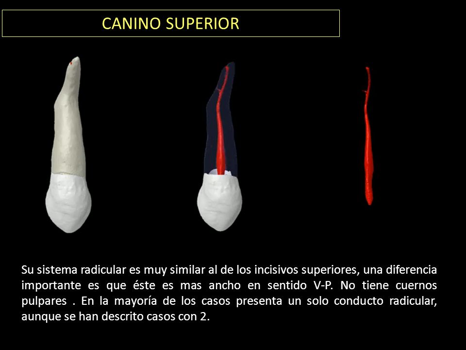 CANINO SUPERIOR