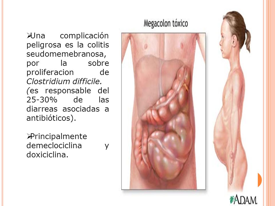 Una complicación peligrosa es la colitis seudomemebranosa, por la sobre proliferacion de Clostridium difficile.