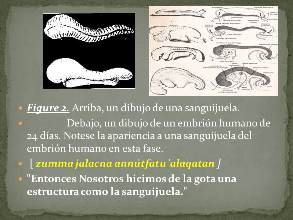Figure 2. Arriba, un dibujo de una sanguijuela.