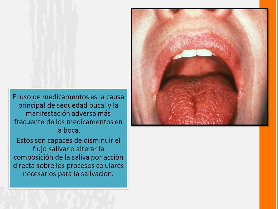 El uso de medicamentos es la causa principal de sequedad bucal y la manifestación adversa más frecuente de los medicamentos en la boca.