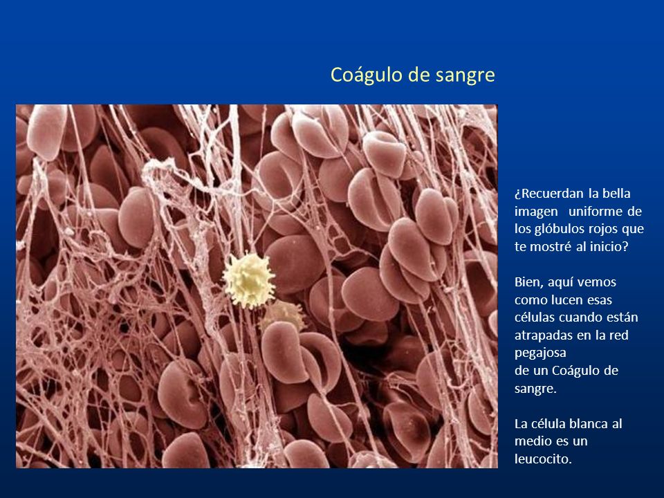 Coágulo de sangre ¿Recuerdan la bella imagen uniforme de los glóbulos rojos que te mostré al inicio