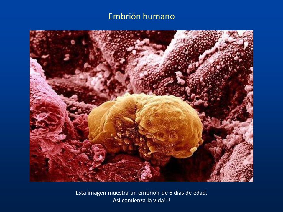 Esta imagen muestra un embrión de 6 días de edad.