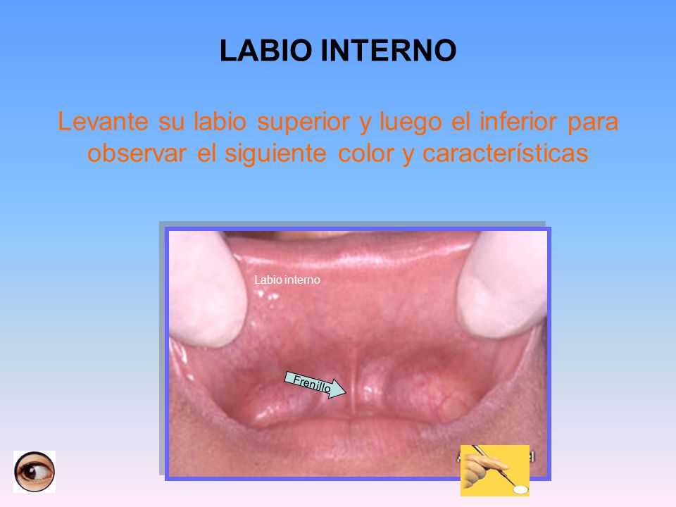LABIO INTERNO Levante su labio superior y luego el inferior para observar el siguiente color y características