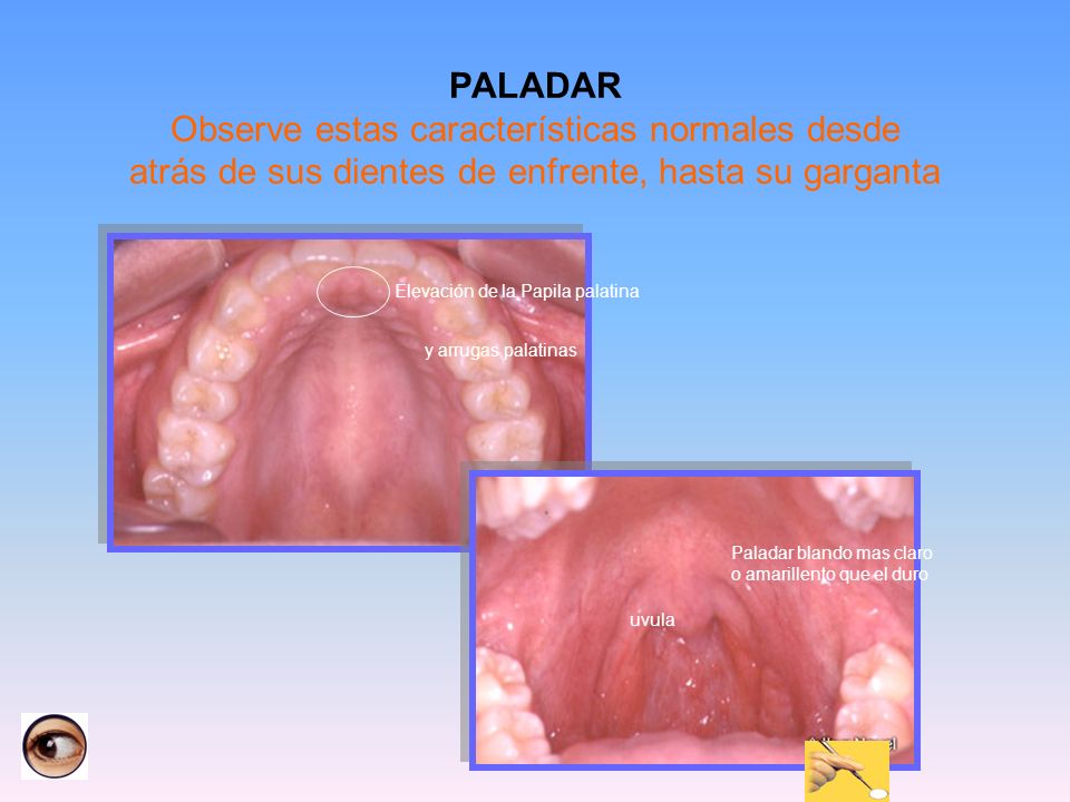 PALADAR Observe estas características normales desde atrás de sus dientes de enfrente, hasta su garganta