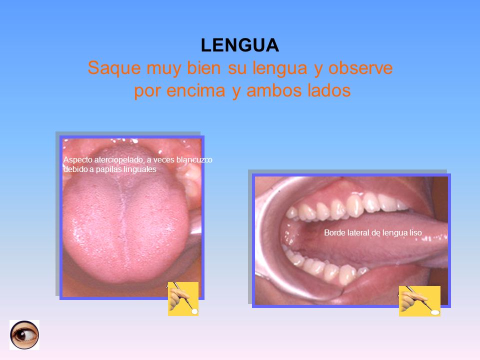 LENGUA Saque muy bien su lengua y observe por encima y ambos lados