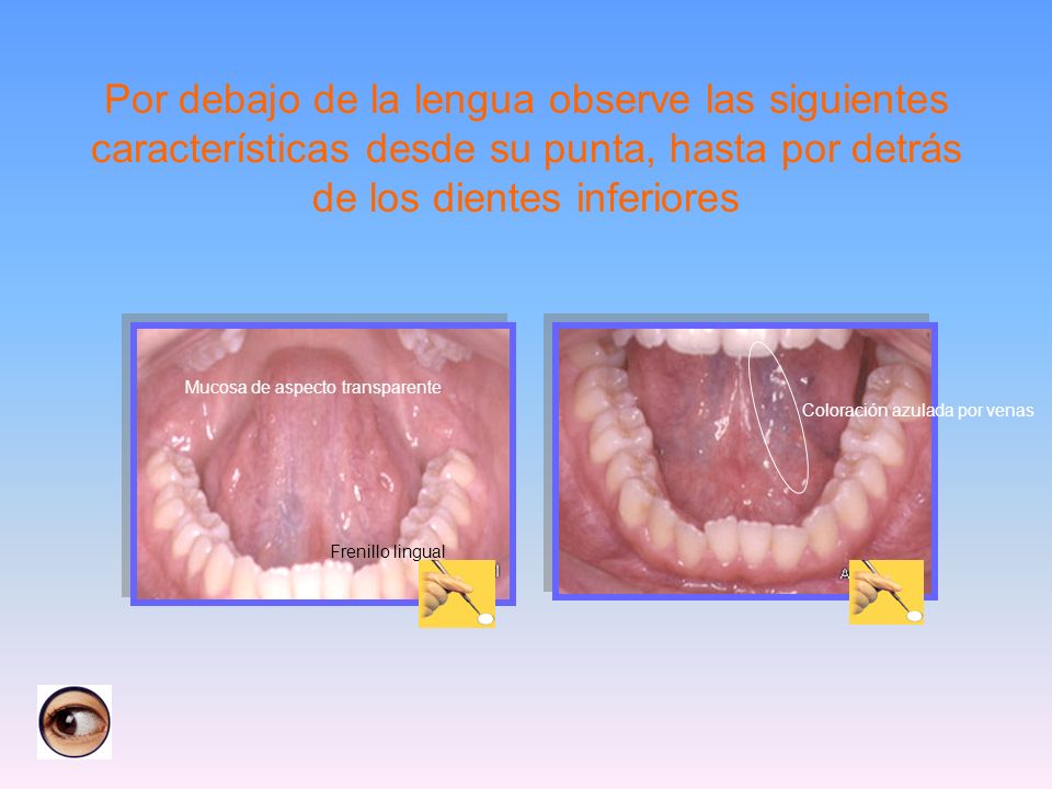 Por debajo de la lengua observe las siguientes características desde su punta, hasta por detrás de los dientes inferiores