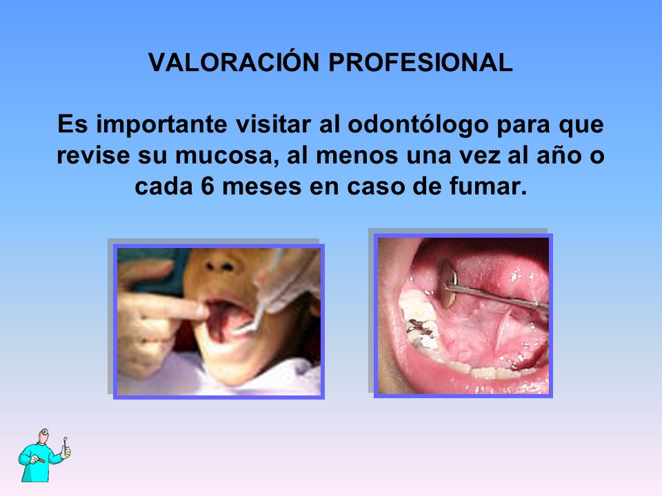 VALORACIÓN PROFESIONAL Es importante visitar al odontólogo para que revise su mucosa, al menos una vez al año o cada 6 meses en caso de fumar.