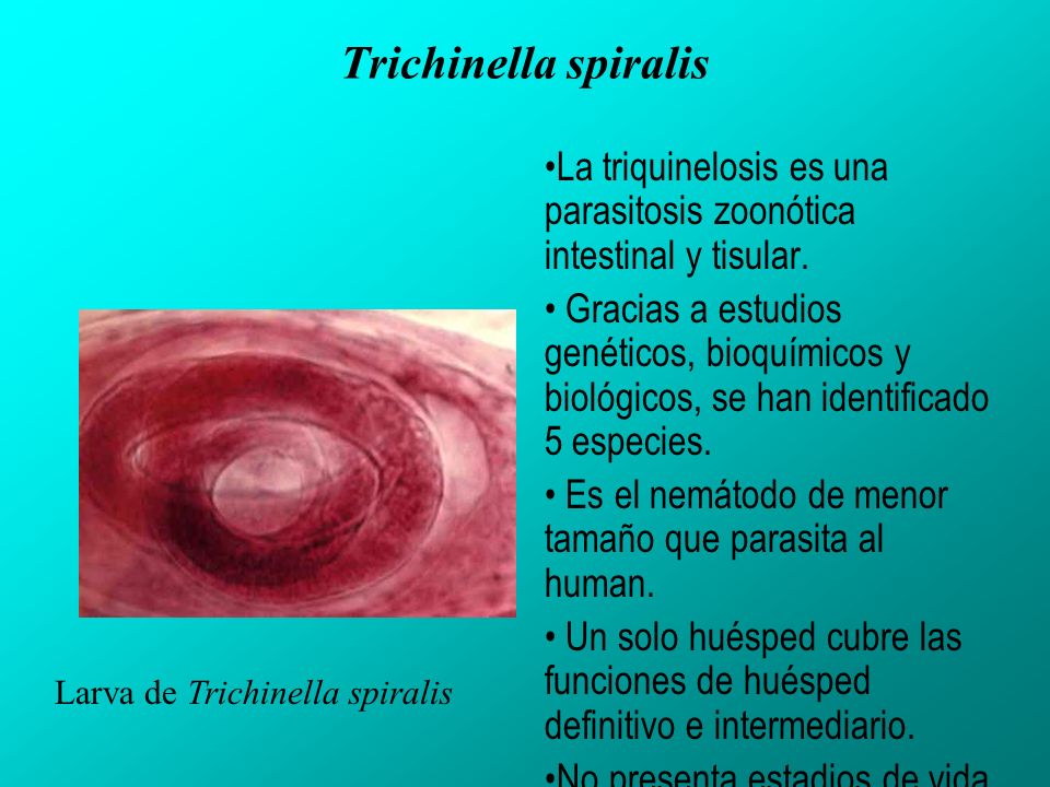 Trichinella spiralis La triquinelosis es una parasitosis zoonótica intestinal y tisular.