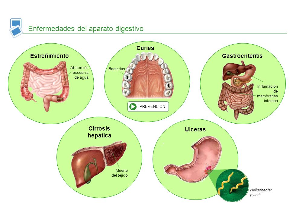 Enfermedades del aparato digestivo