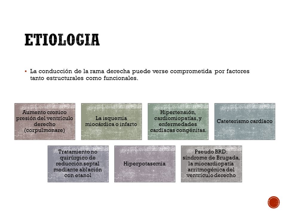 Etiologia La conducción de la rama derecha puede verse comprometida por factores tanto estructurales como funcionales.