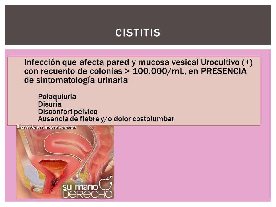 CISTITIS Infección que afecta pared y mucosa vesical Urocultivo (+) con recuento de colonias > /mL, en PRESENCIA de sintomatología urinaria.