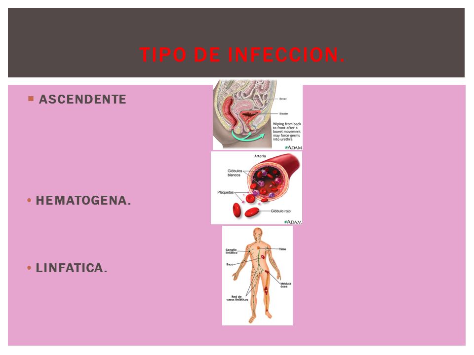 TIPO DE INFECCION. ASCENDENTE HEMATOGENA. LINFATICA.