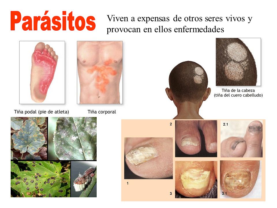 Parásitos Viven a expensas de otros seres vivos y provocan en ellos enfermedades