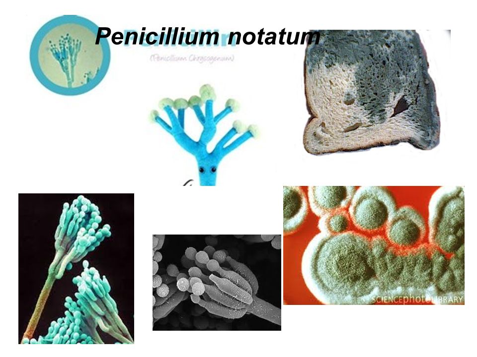 Пеницилл и бактерии. Penicillium notatum пенициллин. Гриб Penicillium notatum. Penicillium notatum под микроскопом. Penicillium notatum микробиология.
