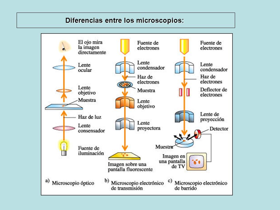 Diferencias entre los microscopios: