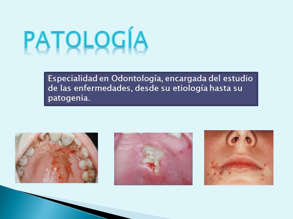 patología Especialidad en Odontología, encargada del estudio de las enfermedades, desde su etiología hasta su patogenia.