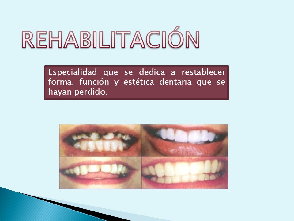 REHABILITACIÓN Especialidad que se dedica a restablecer forma, función y estética dentaria que se hayan perdido.