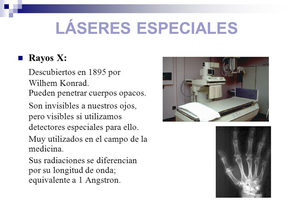 LÁSERES ESPECIALES Rayos X: Descubiertos en 1895 por Wilhem Konrad.
