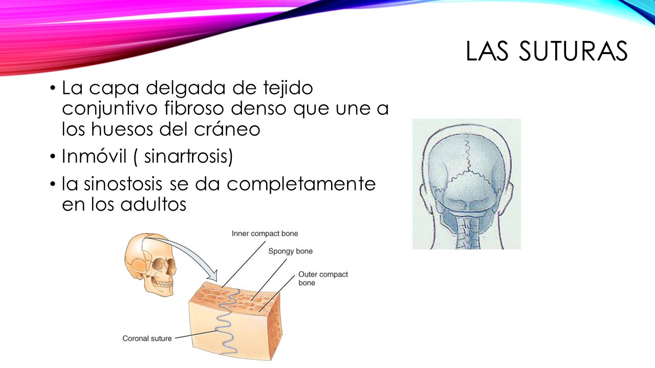 Las suturas La capa delgada de tejido conjuntivo fibroso denso que une a los huesos del cráneo. Inmóvil ( sinartrosis)