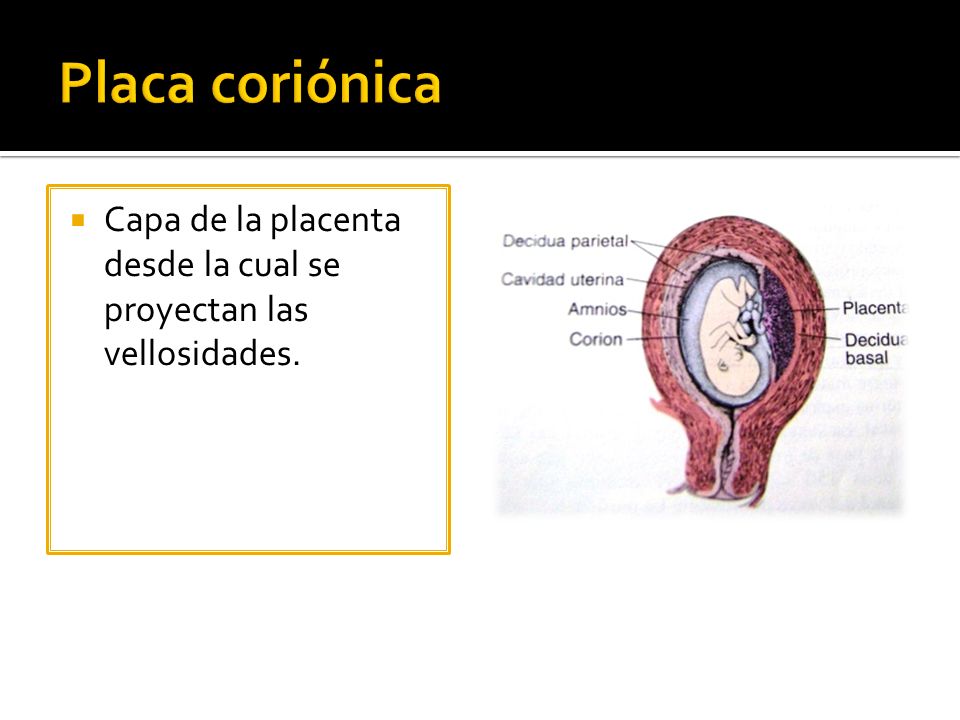Placa coriónica Capa de la placenta desde la cual se proyectan las vellosidades.