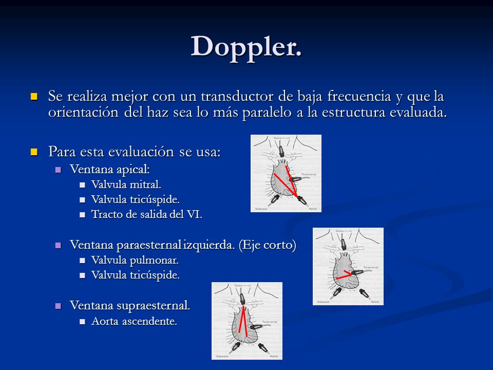 Doppler. Se realiza mejor con un transductor de baja frecuencia y que la orientación del haz sea lo más paralelo a la estructura evaluada.