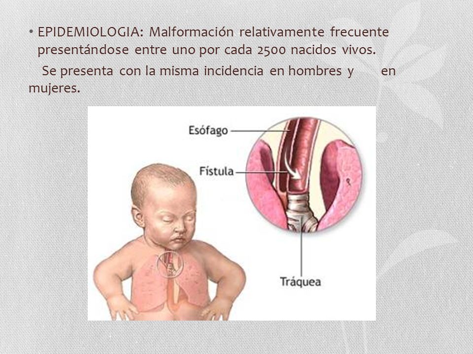 EPIDEMIOLOGIA: Malformación relativamente frecuente presentándose entre uno por cada 2500 nacidos vivos.