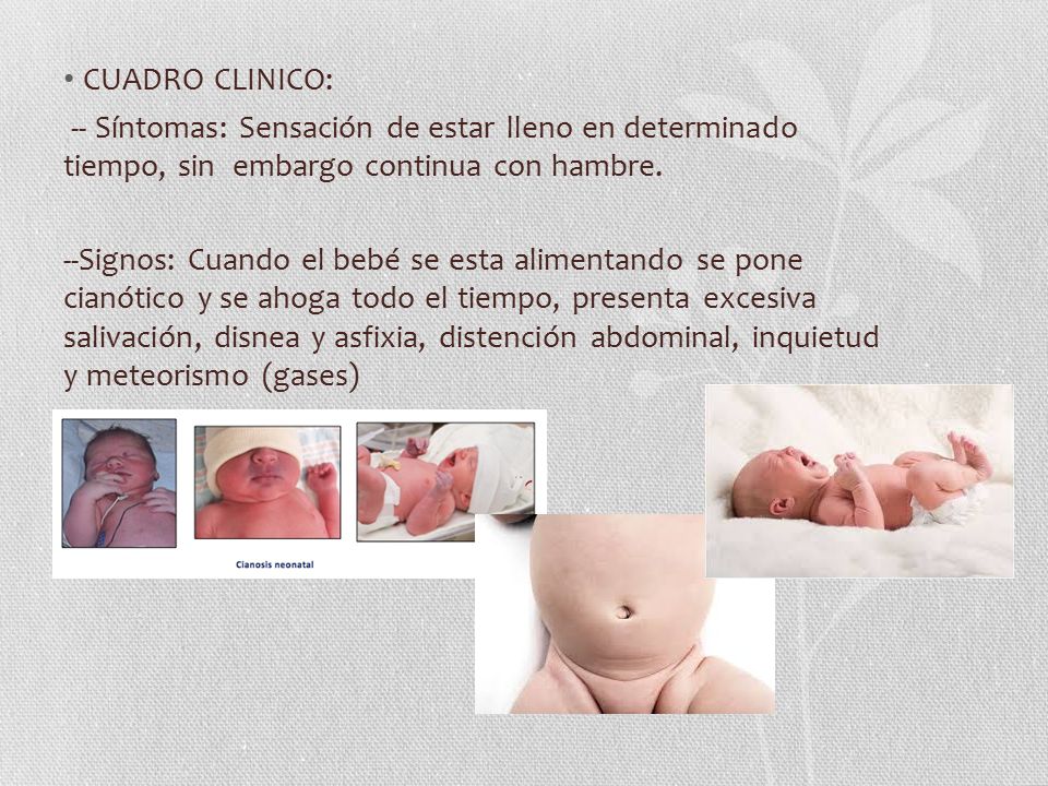 CUADRO CLINICO: -- Síntomas: Sensación de estar lleno en determinado tiempo, sin embargo continua con hambre.