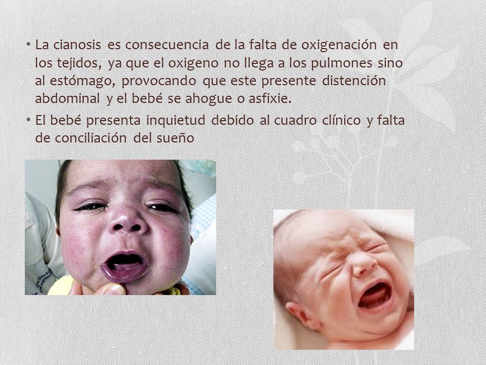 La cianosis es consecuencia de la falta de oxigenación en los tejidos, ya que el oxigeno no llega a los pulmones sino al estómago, provocando que este presente distención abdominal y el bebé se ahogue o asfixie.