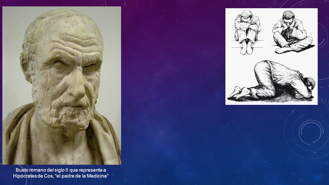 Busto romano del siglo II que representa a Hipócrates de Cos, el padre de la Medicina