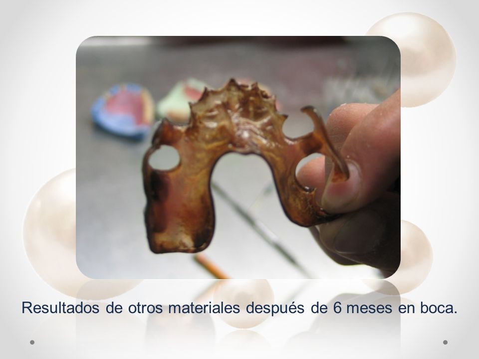 Resultados de otros materiales después de 6 meses en boca.