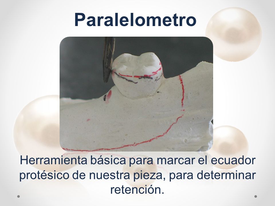 Paralelometro Herramienta básica para marcar el ecuador protésico de nuestra pieza, para determinar retención.