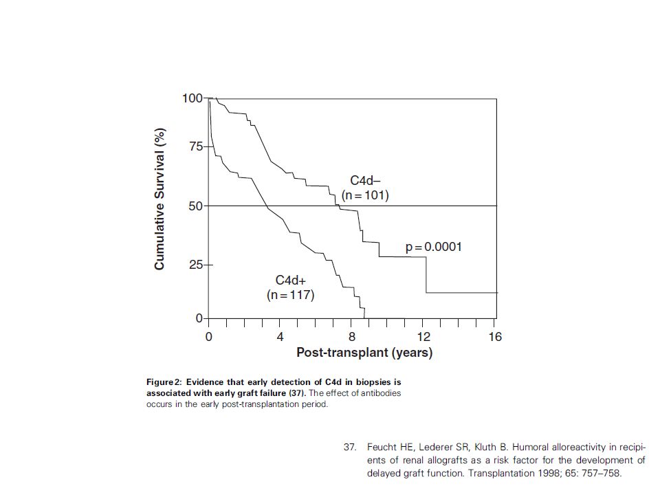 For many years, antibodies were sought in biopsies taken during acute rejections, searching by immunofluorescence for IgG or IgM antibodies, generally to no avail.