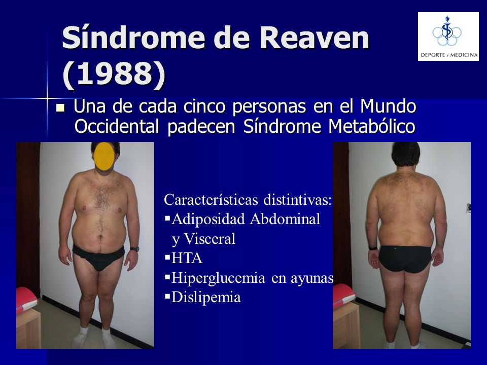 Síndrome de Reaven (1988) Una de cada cinco personas en el Mundo Occidental padecen Síndrome Metabólico.