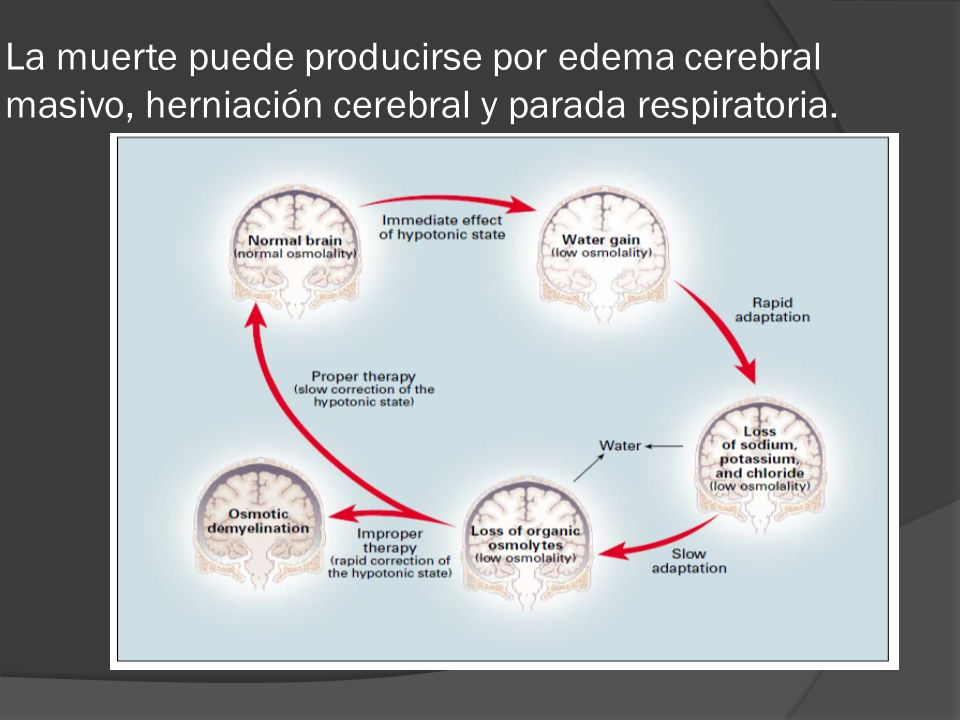 La muerte puede producirse por edema cerebral masivo, herniación cerebral y parada respiratoria.