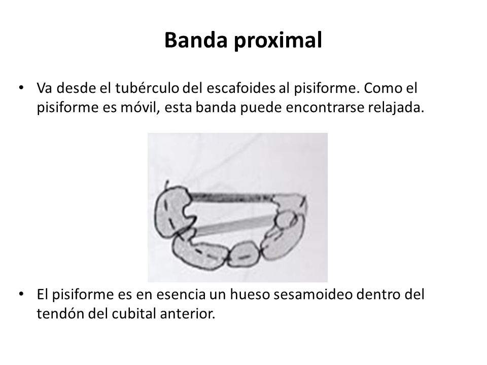 Banda proximal Va desde el tubérculo del escafoides al pisiforme. Como el pisiforme es móvil, esta banda puede encontrarse relajada.